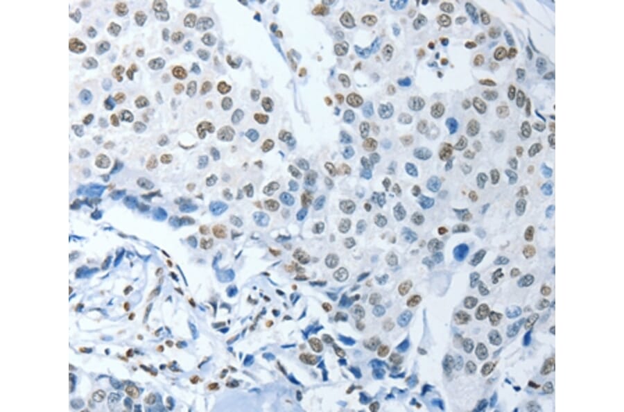 Immunohistochemistry - NEK4 Antibody from Signalway Antibody (37378) - Antibodies.com