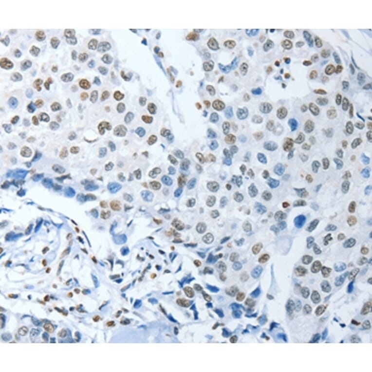 Immunohistochemistry - NEK4 Antibody from Signalway Antibody (37378) - Antibodies.com