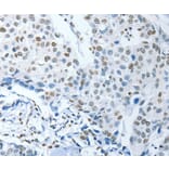 Immunohistochemistry - NEK4 Antibody from Signalway Antibody (37378) - Antibodies.com