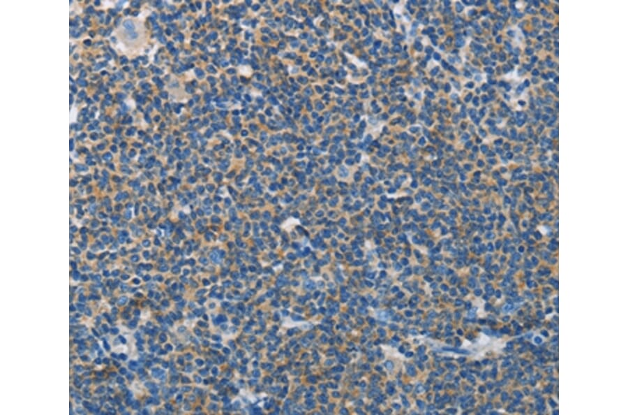 Immunohistochemistry - NEK5 Antibody from Signalway Antibody (37379) - Antibodies.com