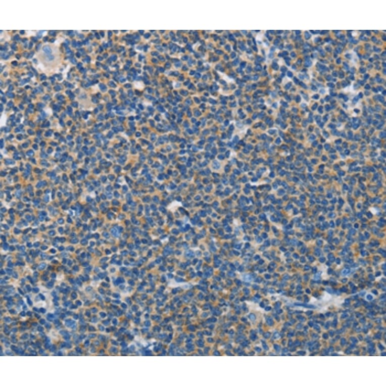 Immunohistochemistry - NEK5 Antibody from Signalway Antibody (37379) - Antibodies.com