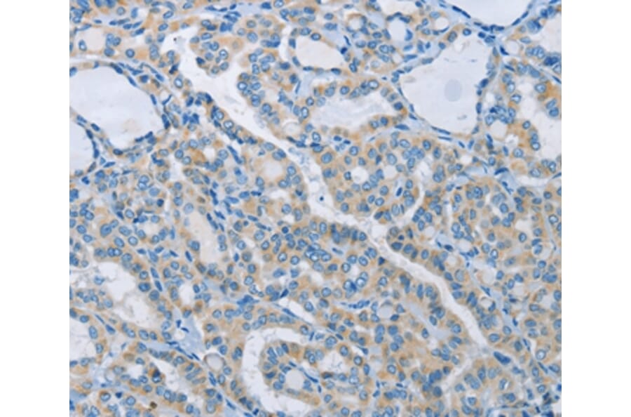 Immunohistochemistry - NEK5 Antibody from Signalway Antibody (37379) - Antibodies.com