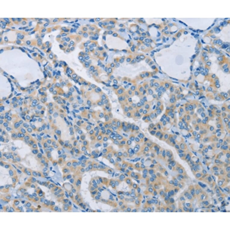 Immunohistochemistry - NEK5 Antibody from Signalway Antibody (37379) - Antibodies.com
