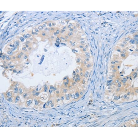 Immunohistochemistry - NEK9 Antibody from Signalway Antibody (37380) - Antibodies.com