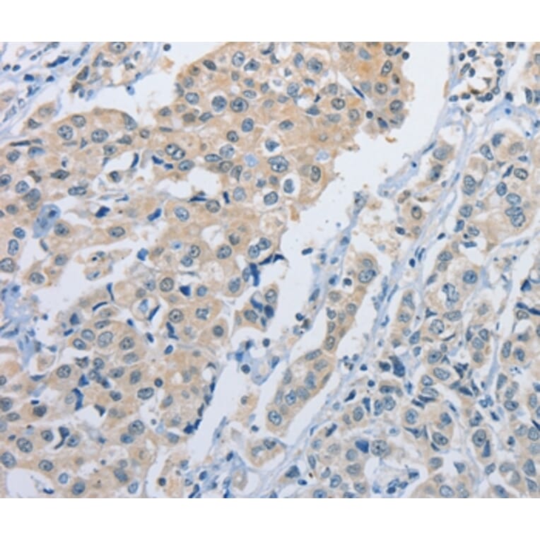 Immunohistochemistry - NEK9 Antibody from Signalway Antibody (37380) - Antibodies.com