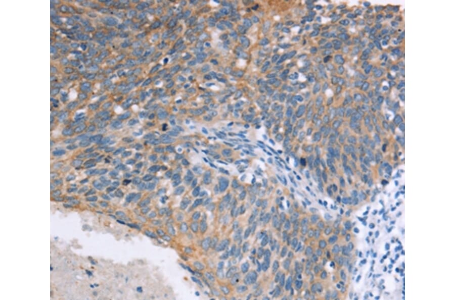 Immunohistochemistry - ELP3 Antibody from Signalway Antibody (37392) - Antibodies.com