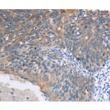 Immunohistochemistry - ELP3 Antibody from Signalway Antibody (37392) - Antibodies.com