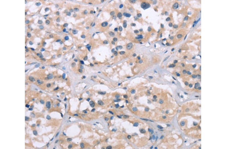 Immunohistochemistry - ELP3 Antibody from Signalway Antibody (37392) - Antibodies.com