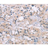 Immunohistochemistry - ELP3 Antibody from Signalway Antibody (37392) - Antibodies.com