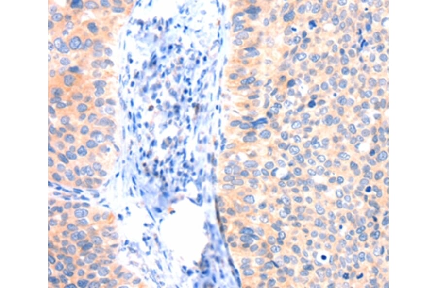 Immunohistochemistry - ANK3 Antibody from Signalway Antibody (37413) - Antibodies.com