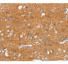 Immunohistochemistry - SNCA Antibody from Signalway Antibody (37420) - Antibodies.com
