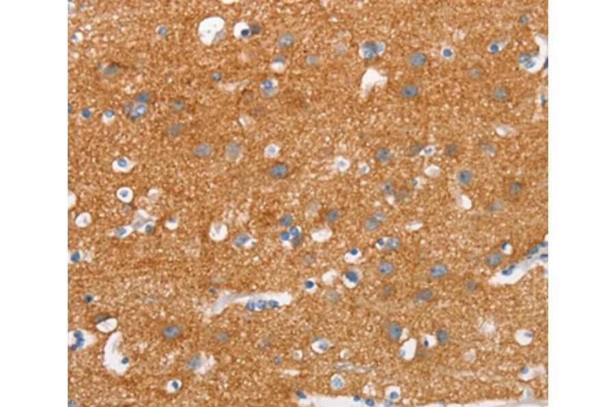 Immunohistochemistry - SNCA Antibody from Signalway Antibody (37420) - Antibodies.com