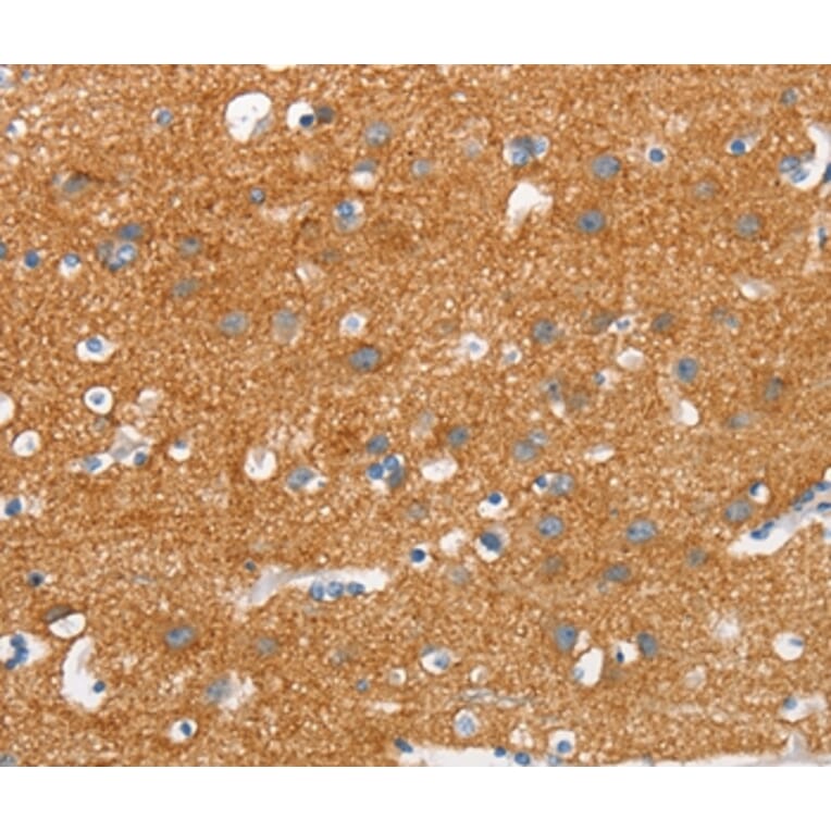 Immunohistochemistry - SNCA Antibody from Signalway Antibody (37420) - Antibodies.com