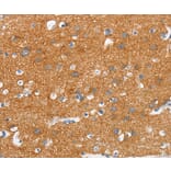 Immunohistochemistry - SNCA Antibody from Signalway Antibody (37420) - Antibodies.com