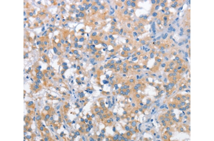 Immunohistochemistry - SNCA Antibody from Signalway Antibody (37420) - Antibodies.com