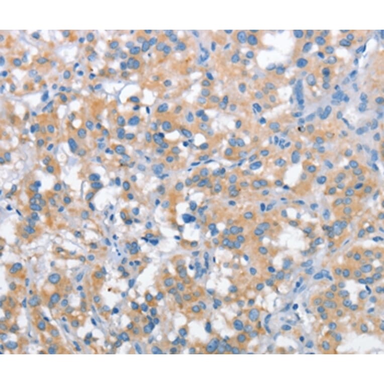 Immunohistochemistry - SNCA Antibody from Signalway Antibody (37420) - Antibodies.com