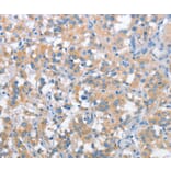 Immunohistochemistry - SNCA Antibody from Signalway Antibody (37420) - Antibodies.com