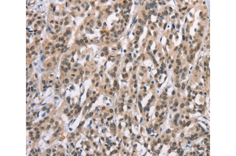 Immunohistochemistry - ADNP Antibody from Signalway Antibody (37424) - Antibodies.com