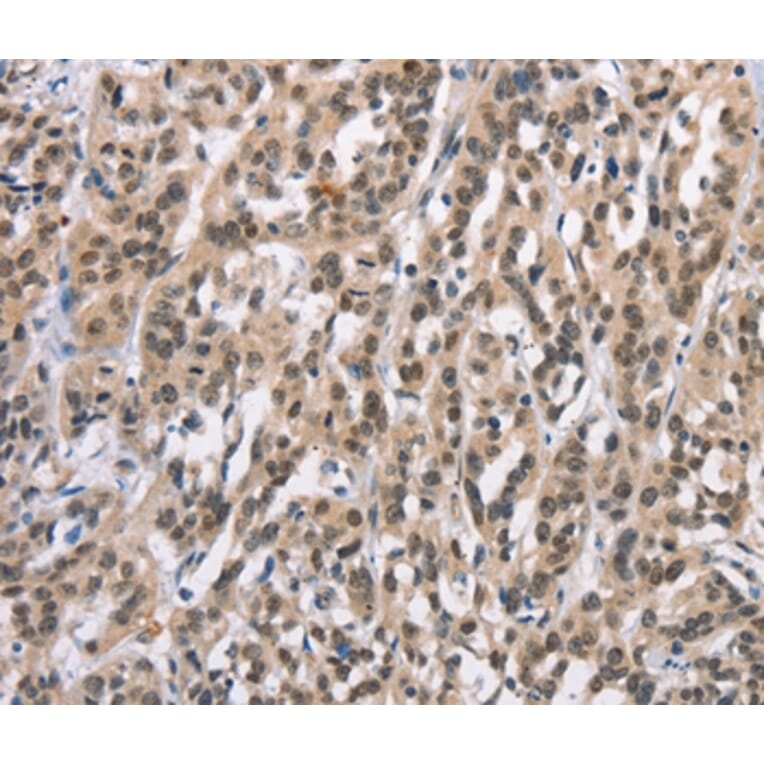 Immunohistochemistry - ADNP Antibody from Signalway Antibody (37424) - Antibodies.com