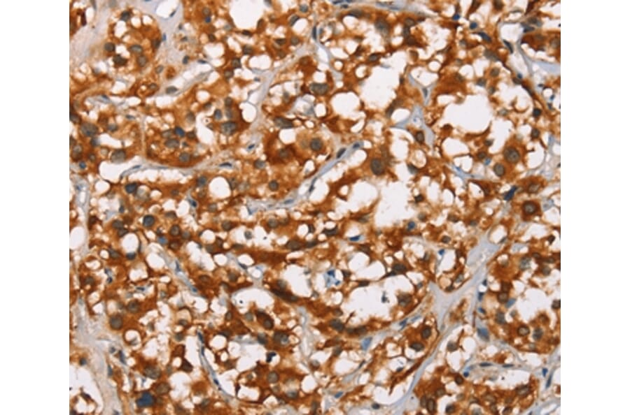Immunohistochemistry - ADNP Antibody from Signalway Antibody (37424) - Antibodies.com