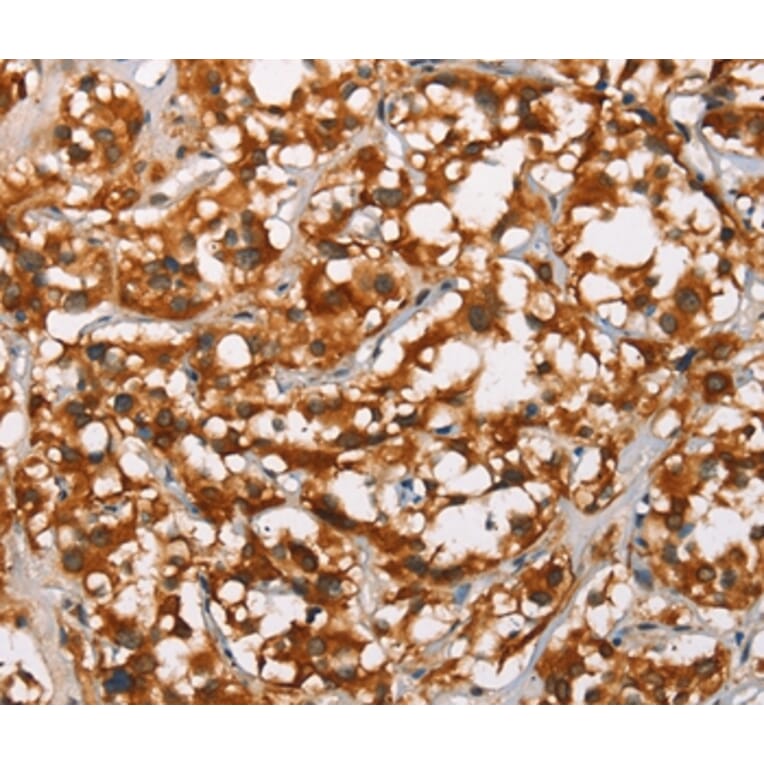 Immunohistochemistry - ADNP Antibody from Signalway Antibody (37424) - Antibodies.com