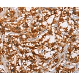 Immunohistochemistry - ADNP Antibody from Signalway Antibody (37424) - Antibodies.com