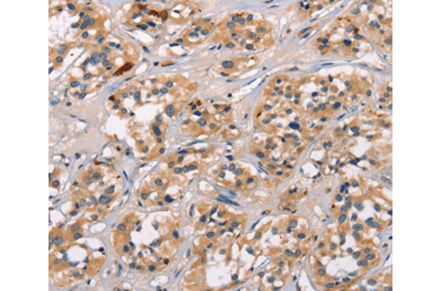 Immunohistochemistry - ATRN Antibody from Signalway Antibody (37433) - Antibodies.com