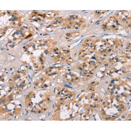 Immunohistochemistry - ATRN Antibody from Signalway Antibody (37433) - Antibodies.com