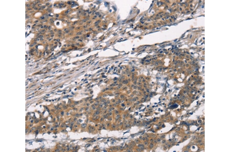Immunohistochemistry - ATRN Antibody from Signalway Antibody (37433) - Antibodies.com