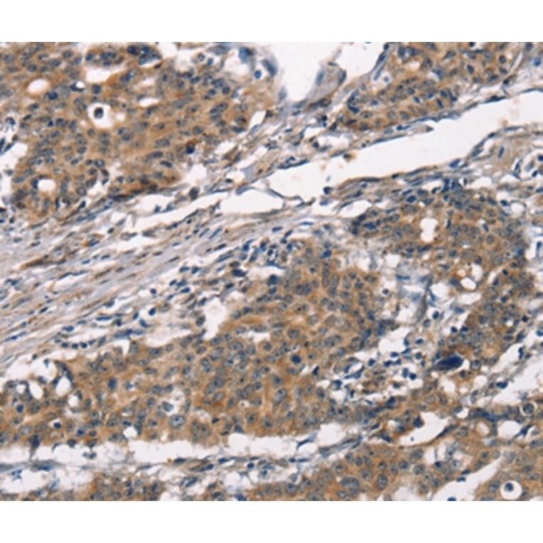 Immunohistochemistry - ATRN Antibody from Signalway Antibody (37433) - Antibodies.com