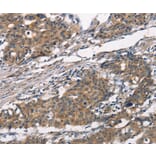 Immunohistochemistry - ATRN Antibody from Signalway Antibody (37433) - Antibodies.com