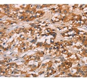 Immunohistochemistry - CD80 Antibody from Signalway Antibody (37436) - Antibodies.com