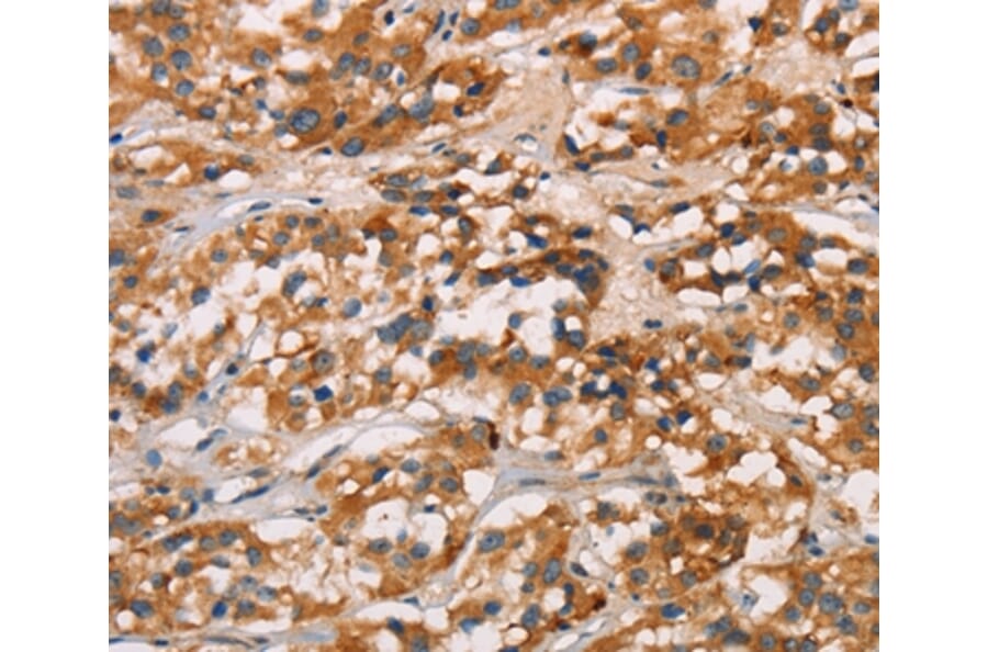 Immunohistochemistry - CD80 Antibody from Signalway Antibody (37436) - Antibodies.com