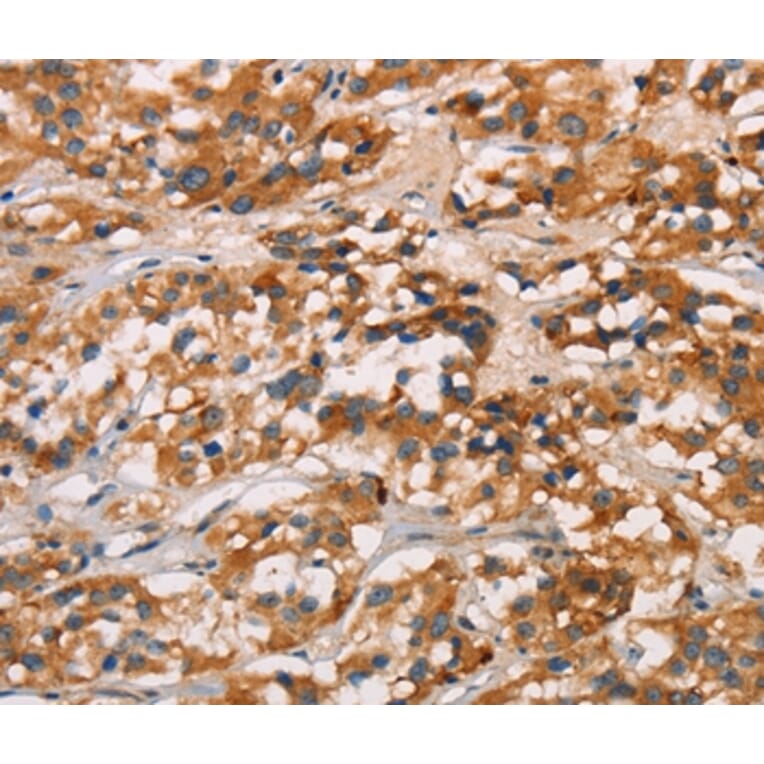 Immunohistochemistry - CD80 Antibody from Signalway Antibody (37436) - Antibodies.com