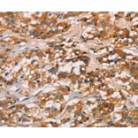 Immunohistochemistry - CD80 Antibody from Signalway Antibody (37436) - Antibodies.com