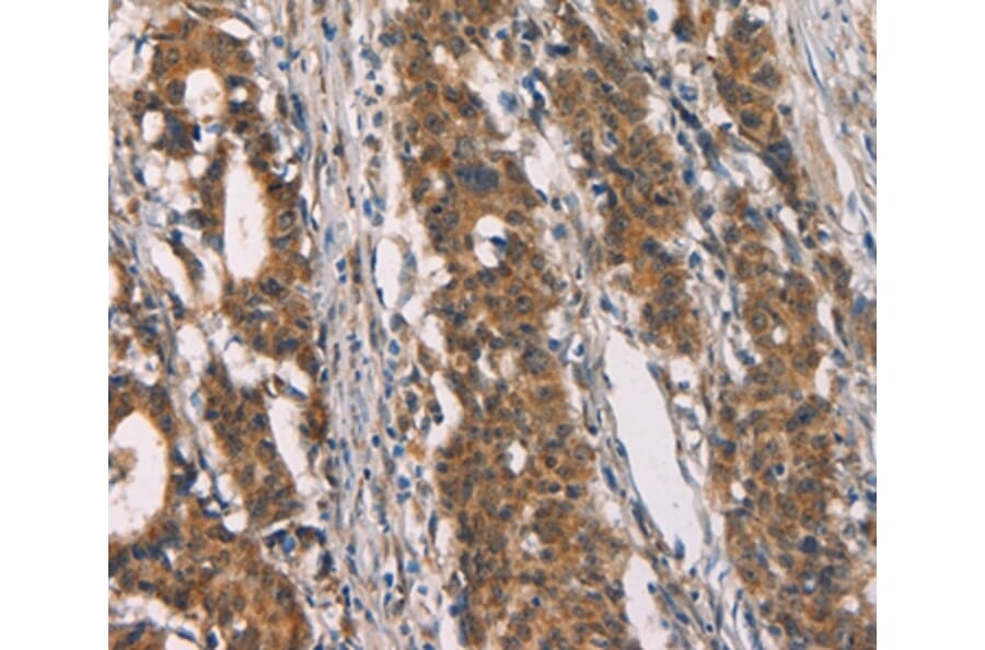 Immunohistochemistry - CD80 Antibody from Signalway Antibody (37436) - Antibodies.com