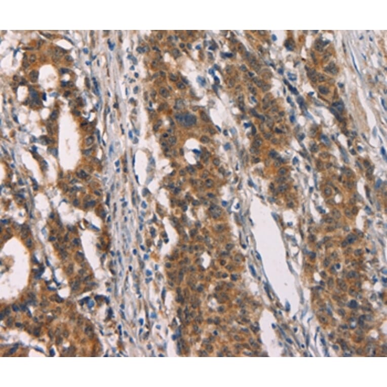 Immunohistochemistry - CD80 Antibody from Signalway Antibody (37436) - Antibodies.com