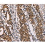Immunohistochemistry - CD80 Antibody from Signalway Antibody (37436) - Antibodies.com