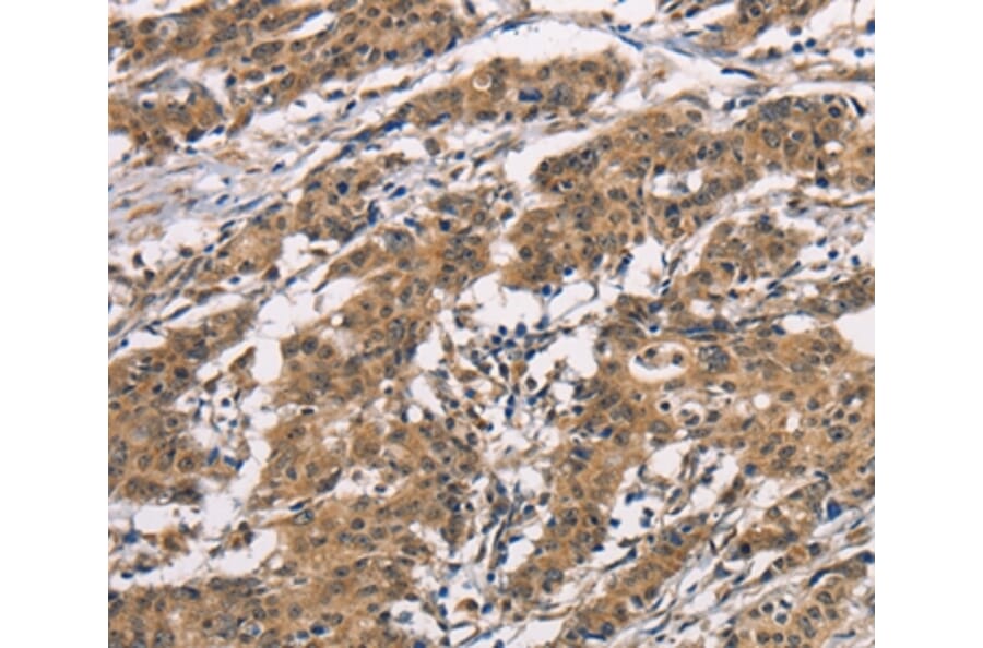 Immunohistochemistry - BAI1 Antibody from Signalway Antibody (37437) - Antibodies.com