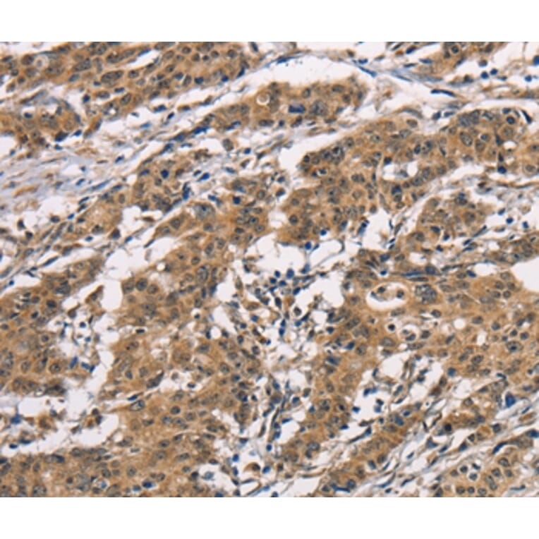 Immunohistochemistry - BAI1 Antibody from Signalway Antibody (37437) - Antibodies.com