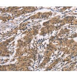 Immunohistochemistry - BAI1 Antibody from Signalway Antibody (37437) - Antibodies.com