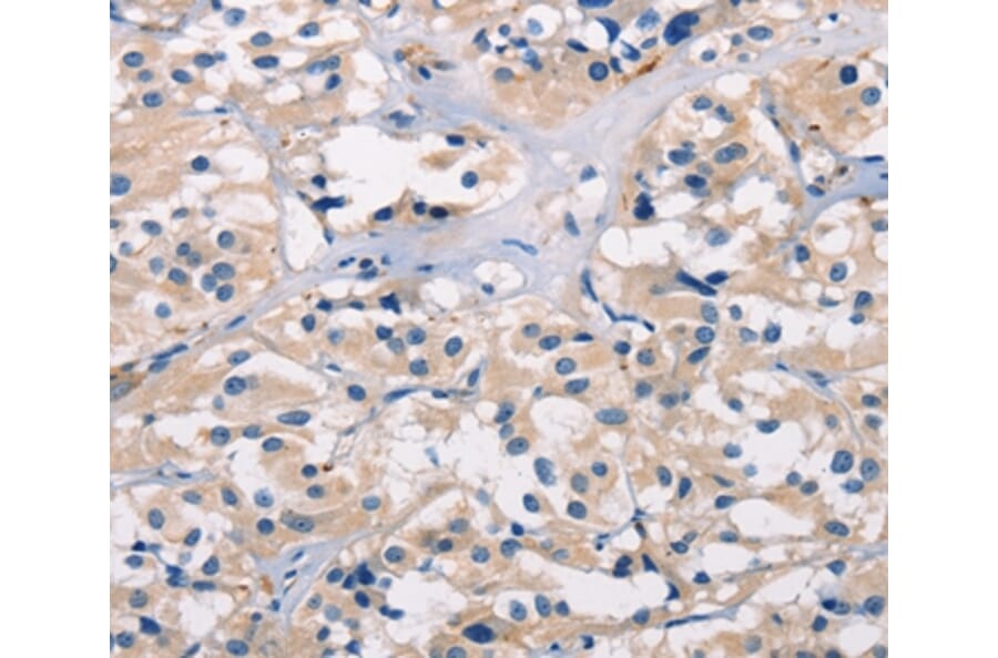 Immunohistochemistry - BAI1 Antibody from Signalway Antibody (37437) - Antibodies.com