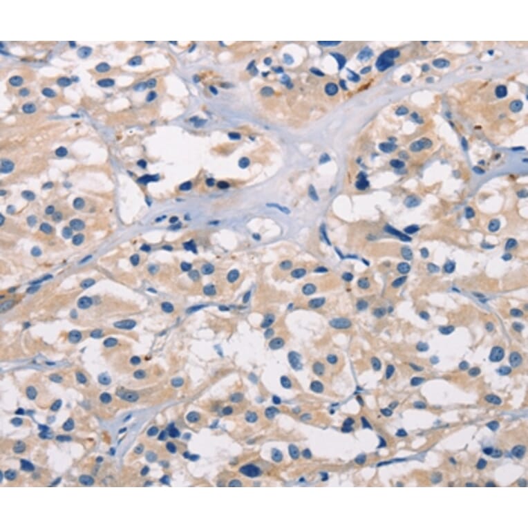 Immunohistochemistry - BAI1 Antibody from Signalway Antibody (37437) - Antibodies.com
