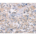 Immunohistochemistry - BAI1 Antibody from Signalway Antibody (37437) - Antibodies.com