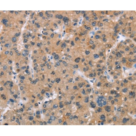 Immunohistochemistry - BAI2 Antibody from Signalway Antibody (37438) - Antibodies.com