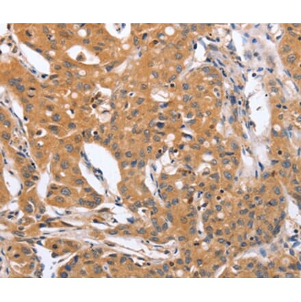 Immunohistochemistry - BLNK Antibody from Signalway Antibody (37442) - Antibodies.com