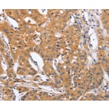 Immunohistochemistry - BLNK Antibody from Signalway Antibody (37442) - Antibodies.com