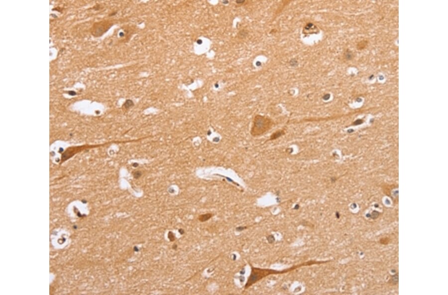 Immunohistochemistry - BLNK Antibody from Signalway Antibody (37442) - Antibodies.com
