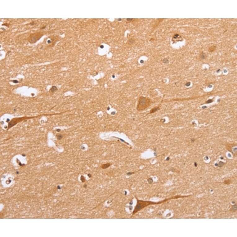 Immunohistochemistry - BLNK Antibody from Signalway Antibody (37442) - Antibodies.com