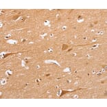 Immunohistochemistry - BLNK Antibody from Signalway Antibody (37442) - Antibodies.com